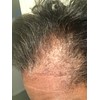 Kreyol Essence - Haitian Black Castor Oil for Skin and