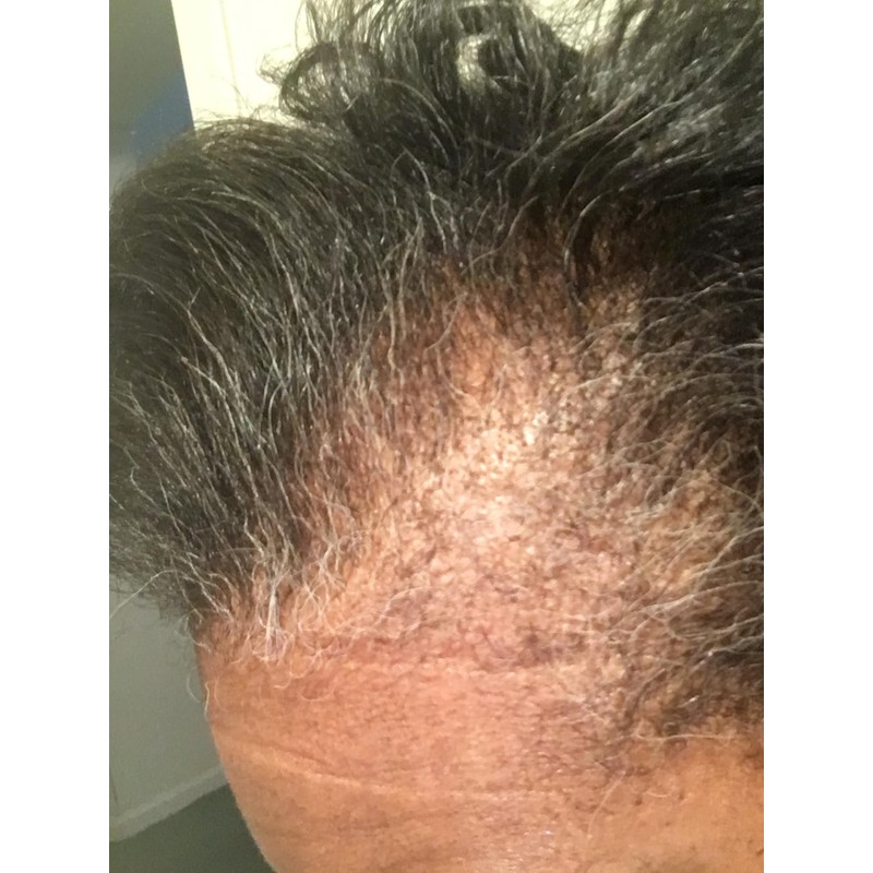 Kreyol Essence - Haitian Black Castor Oil for Skin and