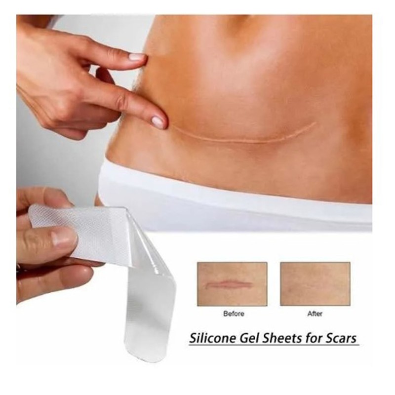 Stretch Mark Patch Soft Silicone Clear Concealed Reusable Strong Adhesive