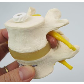 Lumbar (L4,L5) model with herniated cord, connects with intervertebral discs and spinal nerves can be observed - 2 interlocking lumbar models - 3B Scientific
