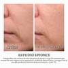 Epionce Renewal Facial Lotion, 1.7 Fluid Ounce by Epionce