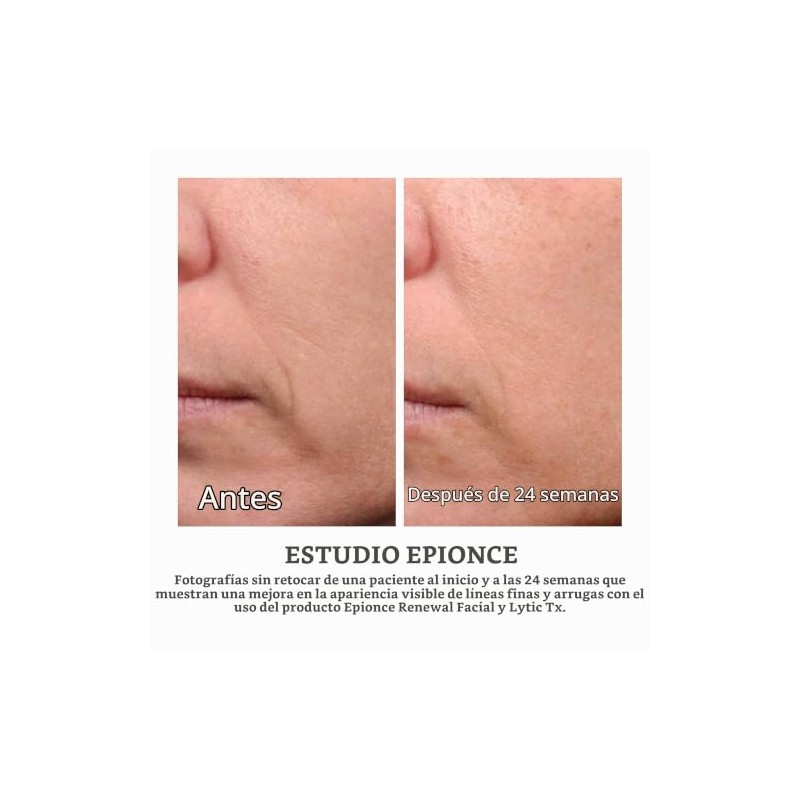 Epionce Renewal Facial Lotion, 1.7 Fluid Ounce by Epionce