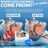 Anti-Snore Devices, Sleep Snoring Solutions - Stop Snoring for Effective