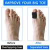 6pcs Overlapping Toe Separators, Black Portable Big Toe Alignment Nail