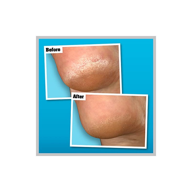 O’Keeffe’s Healthy Feet Overnight 80ml