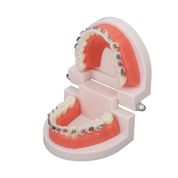 Teeth Dental Demonstration Model, Dental Typodont Tooth Model with Orthodontic Metal Bracket for Dental Teaching Research Dental Laboratory