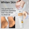 LYDIMOON Underarm melanin removal cream Neck/armpit/elbow/Black acanthoderm precipitation desalination private