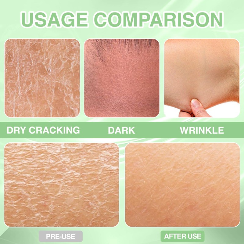 Asheyya 2 Pcs 100g Stdei Luxurious Collagen Firming Cream for