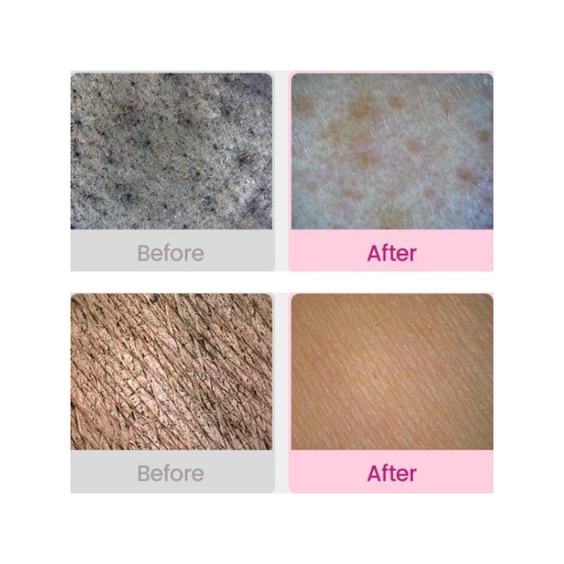 DEWDAP Pack Cleanser 150ml [Cicatea-Pore/Dewtox-Lift], Color:OPIA