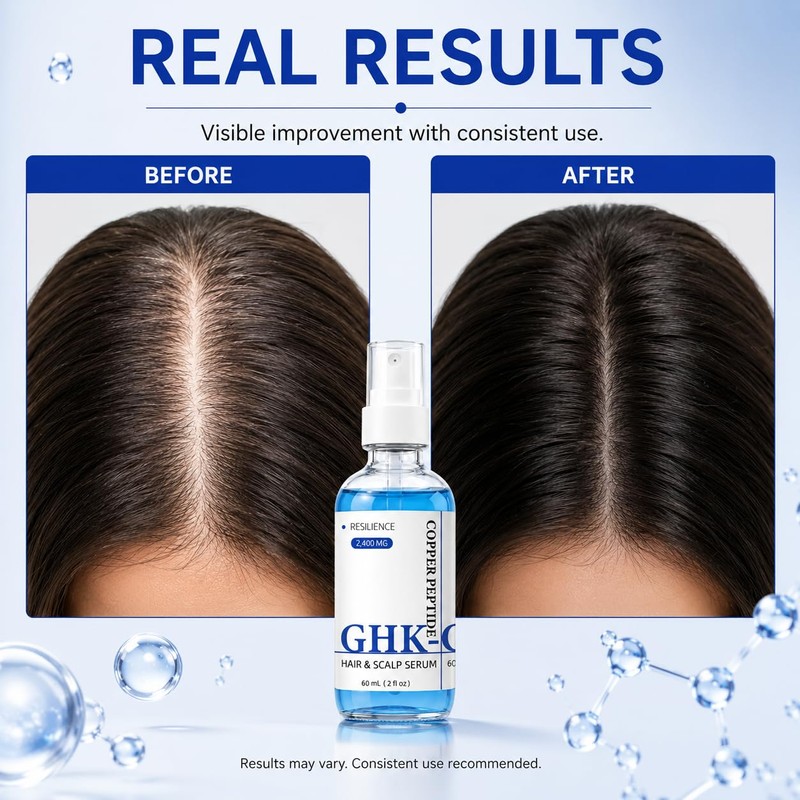 GHK-Cu Peptide Hair Serum, Copper Peptides for Hair Growth Support