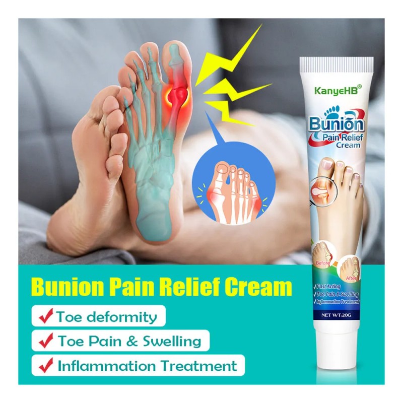 A Pomada Para El Dolor Del Juanete B Pomada Para