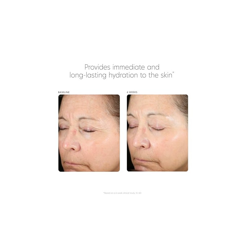PCA SKIN Hyaluronic Acid Boosting Serum, 1 oz.