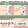 Isshah Bamboo Interdental Brushes, Between Teeth Cleaner Deep Clean Brush,