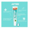 Crema Corporal Bye Bites After Aloe Vera Picaduras 20g 2pz