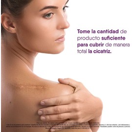 CICATRICURE - Gel cicatrices y estrias. Disminuye tamaño, textura y color de cicatrices y estrias de cirugías, cortaduras, rasguños, quemaduras y acné, tubo con 30g