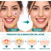 Parches para Acne, 320 Pcs Parches para Granos Estrella de
