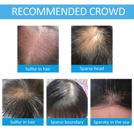 Hair Building Fibers for Thinning Hair with Spray Applicator Pump Nozzle, Natural Keratin & Undetectable, Instantly Fuller, Thicker Look, Conceals Hair Loss in Seconds, Hair Powder for Women & Men