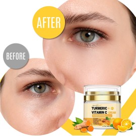 Dermaxgen Pure TURMERIC + 30% VITAMIN C  Moisturizing Wrinkles Fine line Remover