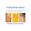 Crema Para Lipomas Y Bultos Grasos South Moon 20g Ginger