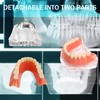 Dental Model Overdenture Transparent Dental Implants Model Detachable Model Lower