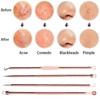 Blackhead Remover Tool Kit,4 Pieces Comedone Extractor Tool Blemish Whitehead