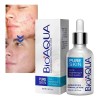 "Pure Skin crema gotero antiacné 30 g"