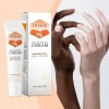 Crema Que Elimina La Melanina, Aclara El Tono Y Mejora