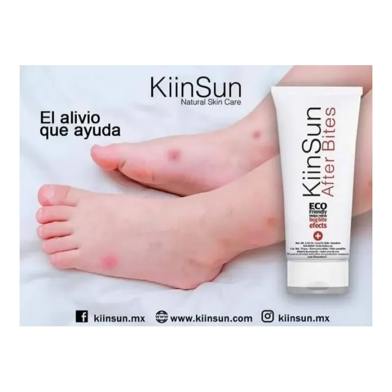 After Bite Natural 70 Ml, Eco Friendly, Kiin Sun