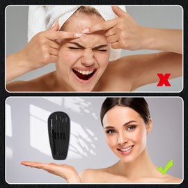 FVION 5 Pieces Blackhead Remover Comedone Squeezer Set, Pimple Expressing Tool, Tweezers, Blackhead Remover with Acne Tool for Nose Face Care - Black