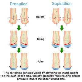Endoto Supination and Pronation Correction Insoles for Men Women Kids Toddlers, Adjustable Corrective Inserts for Over Supination and Overpronation(Size:L)