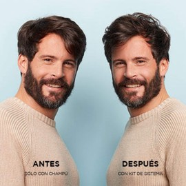 Nioxin Acondicionador Sistema #2 para Cabello Natural con Caída Excesiva, 300 ml