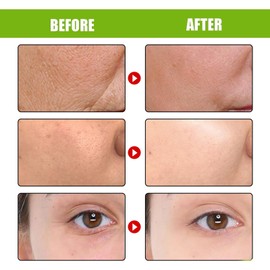 2PCS New Retinal Shot Tightening Booster,Retinol Shot Tightening Serums,Retinol Serum for Face Retinol Eye Cream,Anti Wrinkle and Firming Reti-nol Cream,Moisturizing Reti-nol Cream for Face and Eye