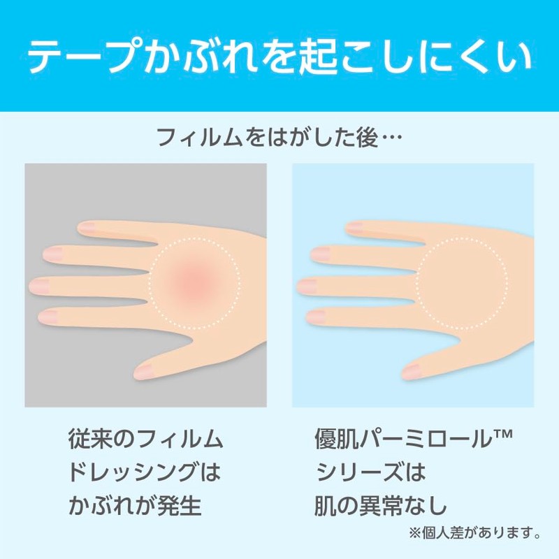 Nitoms Yu-Ki Permiroll (Handy Roll) Skin-friendly, Less Likely to Cause