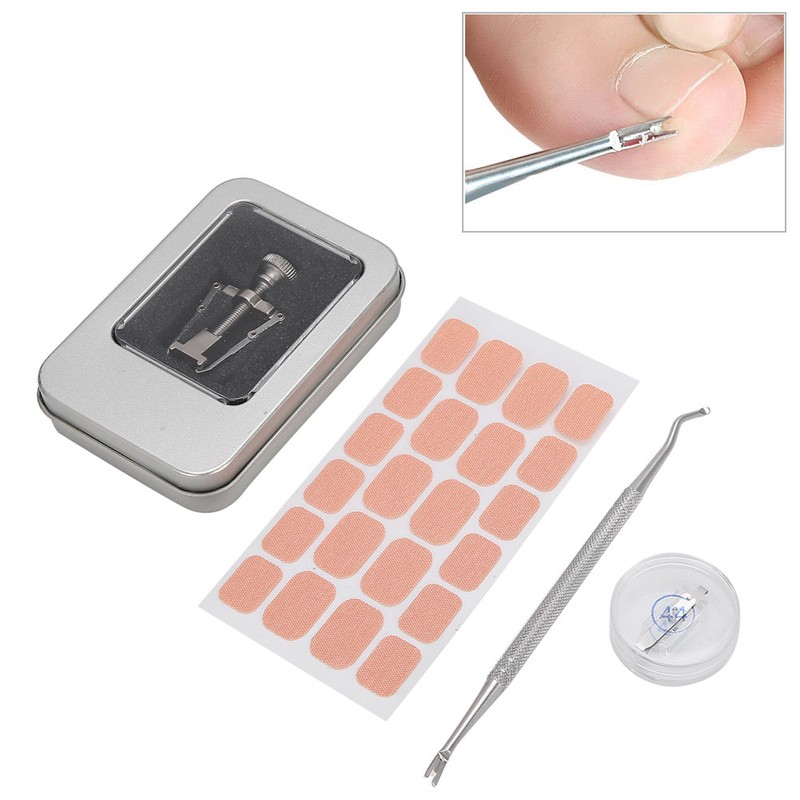 Ingrown Toenail Correction Patch Ingrown Nail Corrector Nail Insert Buckle