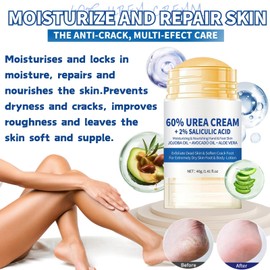 60% Urea Cream - Urea Cream 60 Percent for Feet - Cracked Heel Repair Cream - Ure_a Foot Cream Stick Plus 2% Salicylic Acid For Calluses - Foot Crea_m For Cracked Heels And Dry Skin 1pc