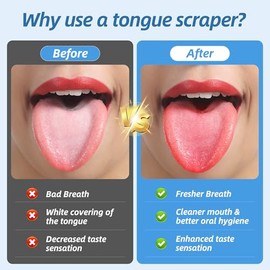 Alosalut Paquete de 6 raspadores de lengua - Limpiador de lengua reutilizable y fácil de limpiar con estuche de viaje para adultos y niños - Acero ino