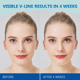 Chin Strap for Sleeping for Women, V Line Lifting Mask w/ 3D Face Roller & Hyaluronic Acid Serum for Face Lifting and Jawline Shaper | Comfortable, Adjustable, and Pressure-Free (Pink)