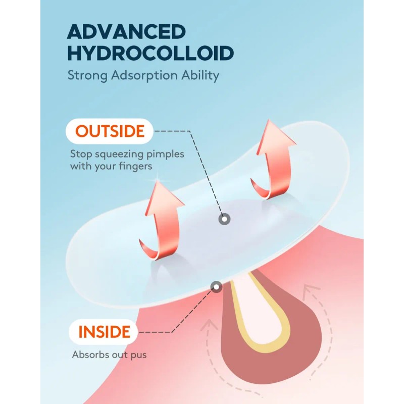 Grandes Parches De Espinilla, Parches De Acné De Litbear Par