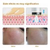 30 Cartuchos Para Dermapen, Dr. Pen 12, 36, 42, Nano
