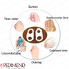 PEDIMEND Two Hole Gel Small Toe Separator (12 PACK) -