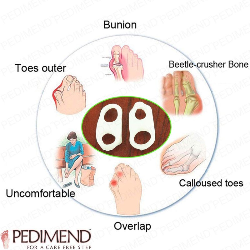 PEDIMEND Two Hole Gel Small Toe Separator (12 PACK) -