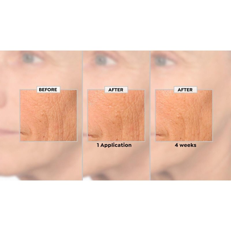 NassifMD Hydro-Screen Serum 4 oz Pump Bottle Hyaluronic Acid Retinol