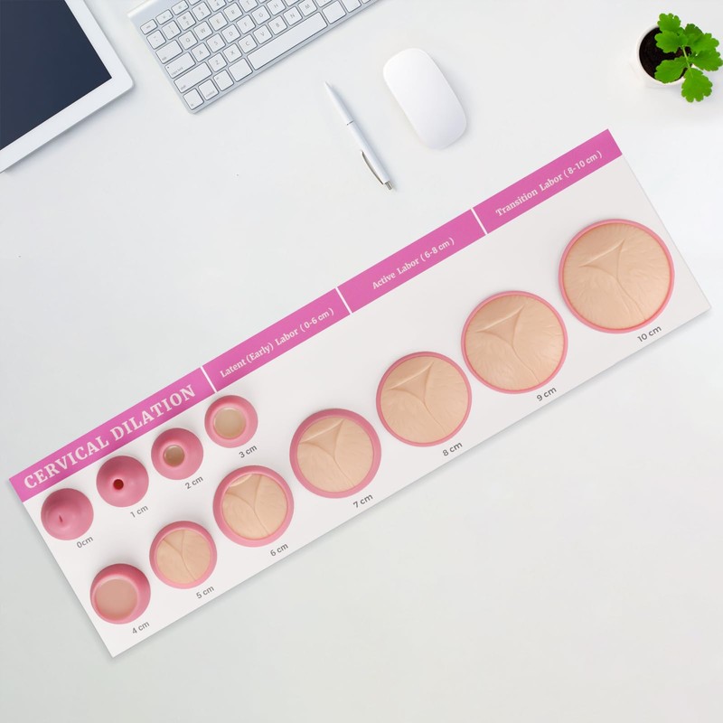 MedEduQuest Cervical Dilation Simulator with 0-10cm, Gynecological Examination Model, for
