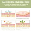 Moon & Back Parches para acné 108 Pack, Parches hidrocoloides