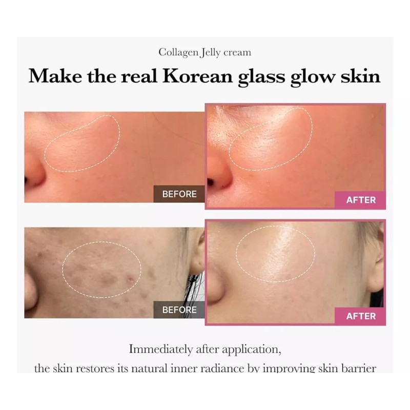 Medicube Collagen Jelly Cream -Niacinamide and Collagen 3.71 fl oz