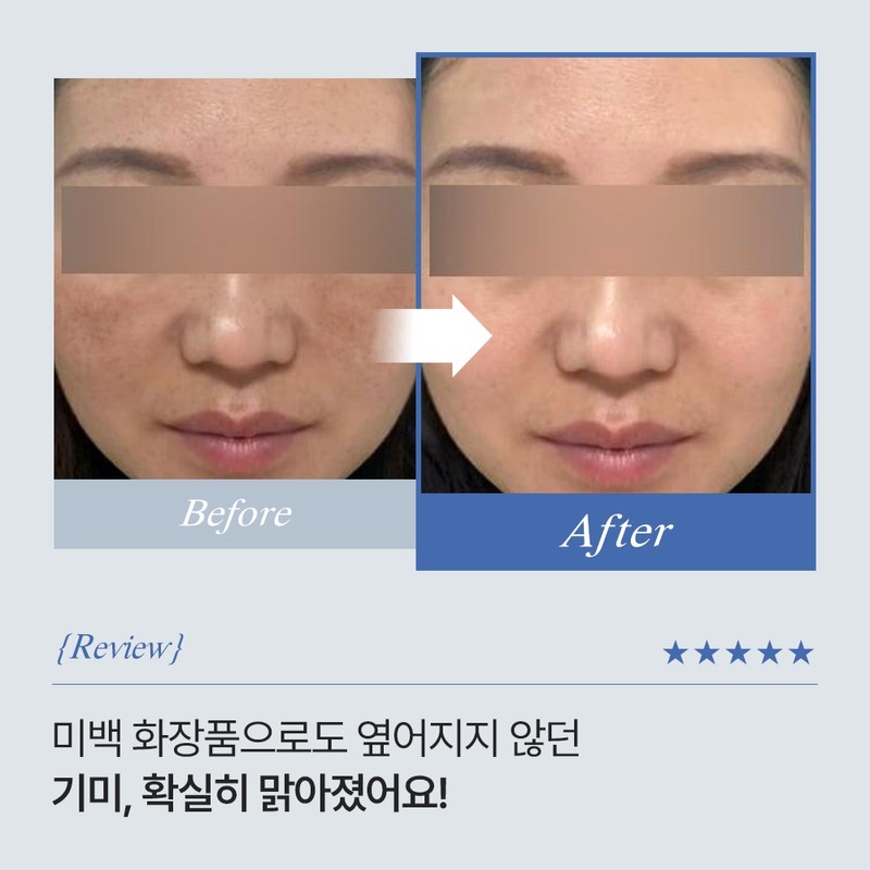 Moref Freckles and Blemishes Improvement Antiox-5 Toning Ampoule 50ml x