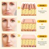 Bee Venom Skin Restoration Cream, Professional Bee Venom Skin Cream,deeply