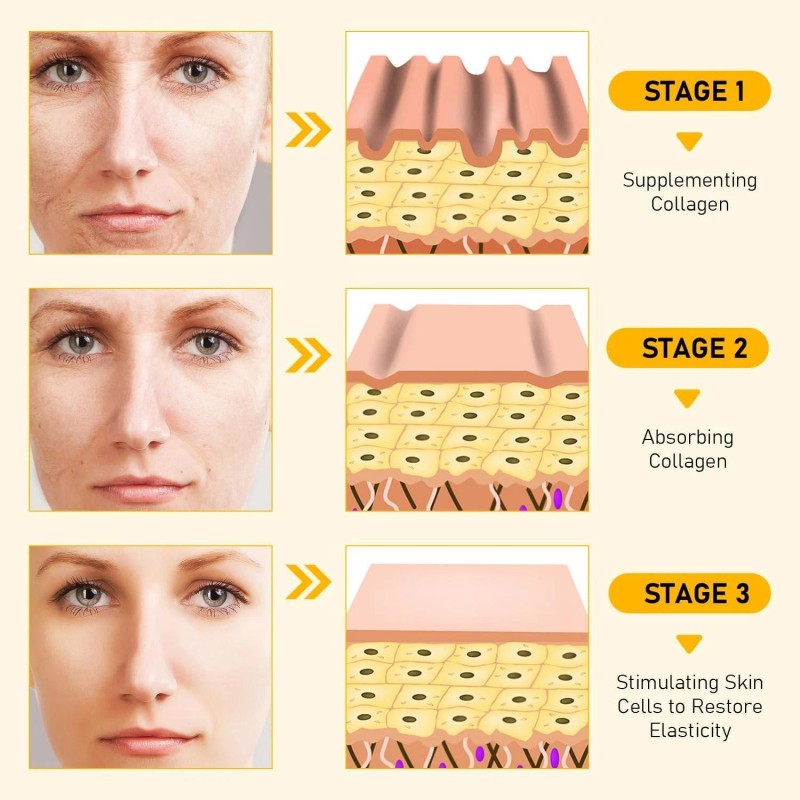 Bee Venom Skin Restoration Cream, Professional Bee Venom Skin Cream,deeply
