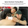 Scoliosis Measuring Tool 0‑30° Testing Range Accurate Data Back Spine