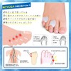 Suporya Toe Supporters, Easy to Attach, Soft, Less Discomfort, Gel